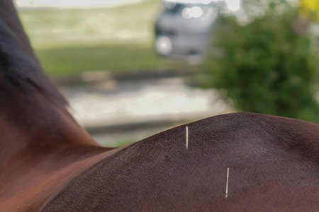 Dry Needling